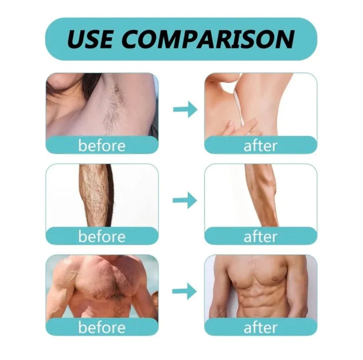 Original Ecrin Hair Removal Spray
