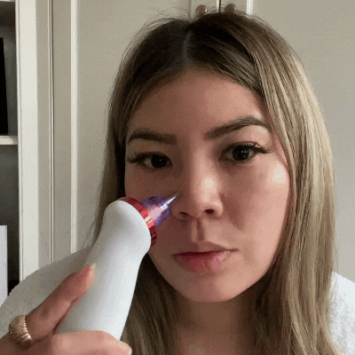 Electric Blackhead Acne Oil Remover Vacuum Suction